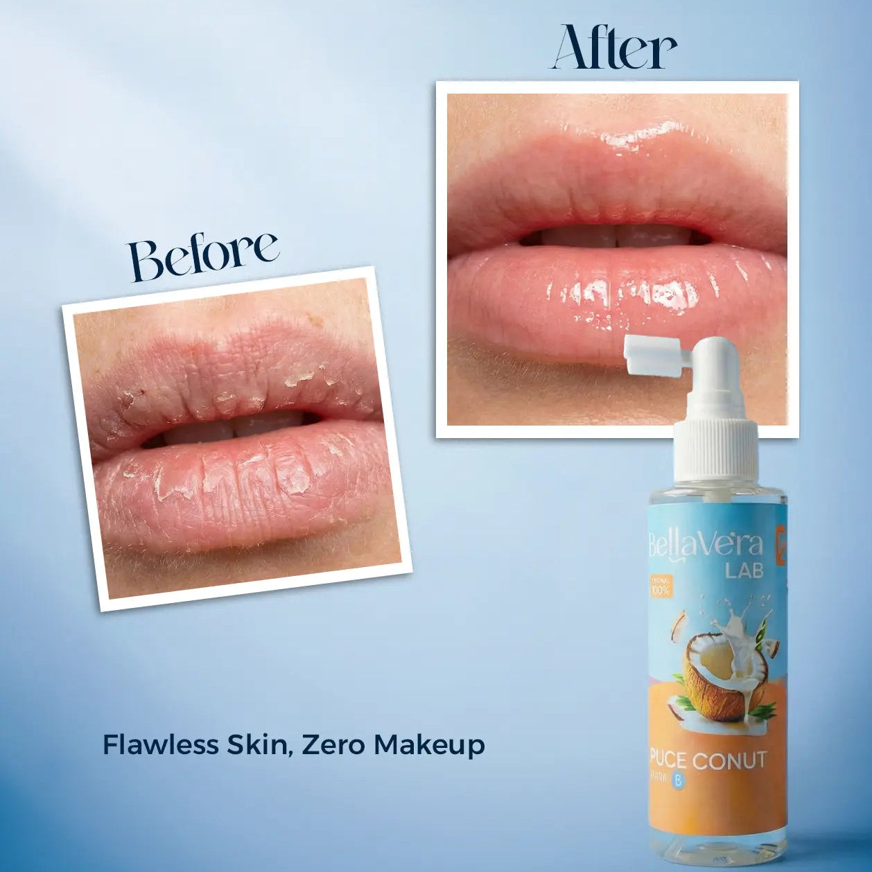 Bellavera Lab-100% Pure Coconut Oil (The Ultimate Multitasker) - Before and After Effect on Lips