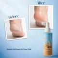 Bellavera Lab-100% Pure Coconut Oil (The Ultimate Multitasker) - Before and After Softness Feet 