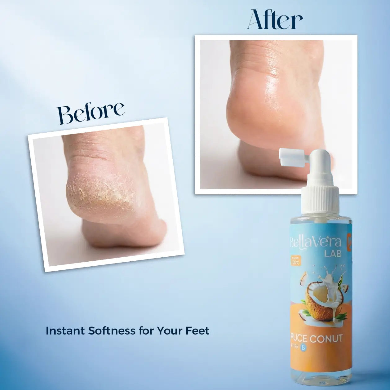 Bellavera Lab-100% Pure Coconut Oil (The Ultimate Multitasker) - Before and After Softness Feet 