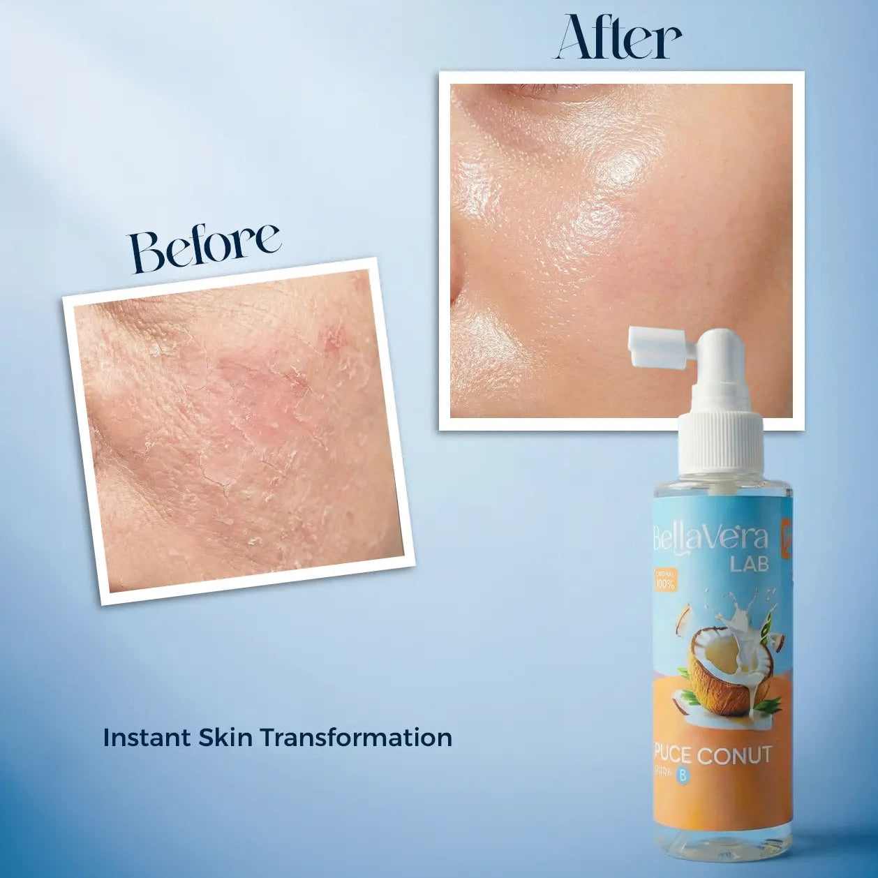 Bellavera Lab-100% Pure Coconut Oil (The Ultimate Multitasker) - Before and after Skin Transformation