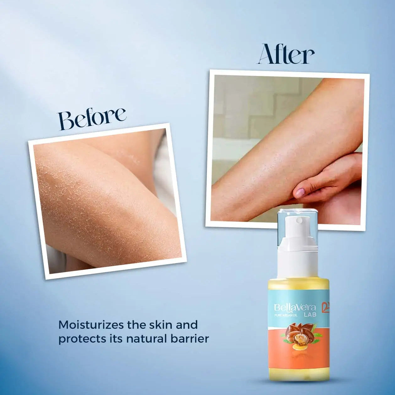 Bellavera Lab - 100% Pure Moroccan Argan Oil (Liquid Gold) - Before and After Effect Moisturizes Skin
