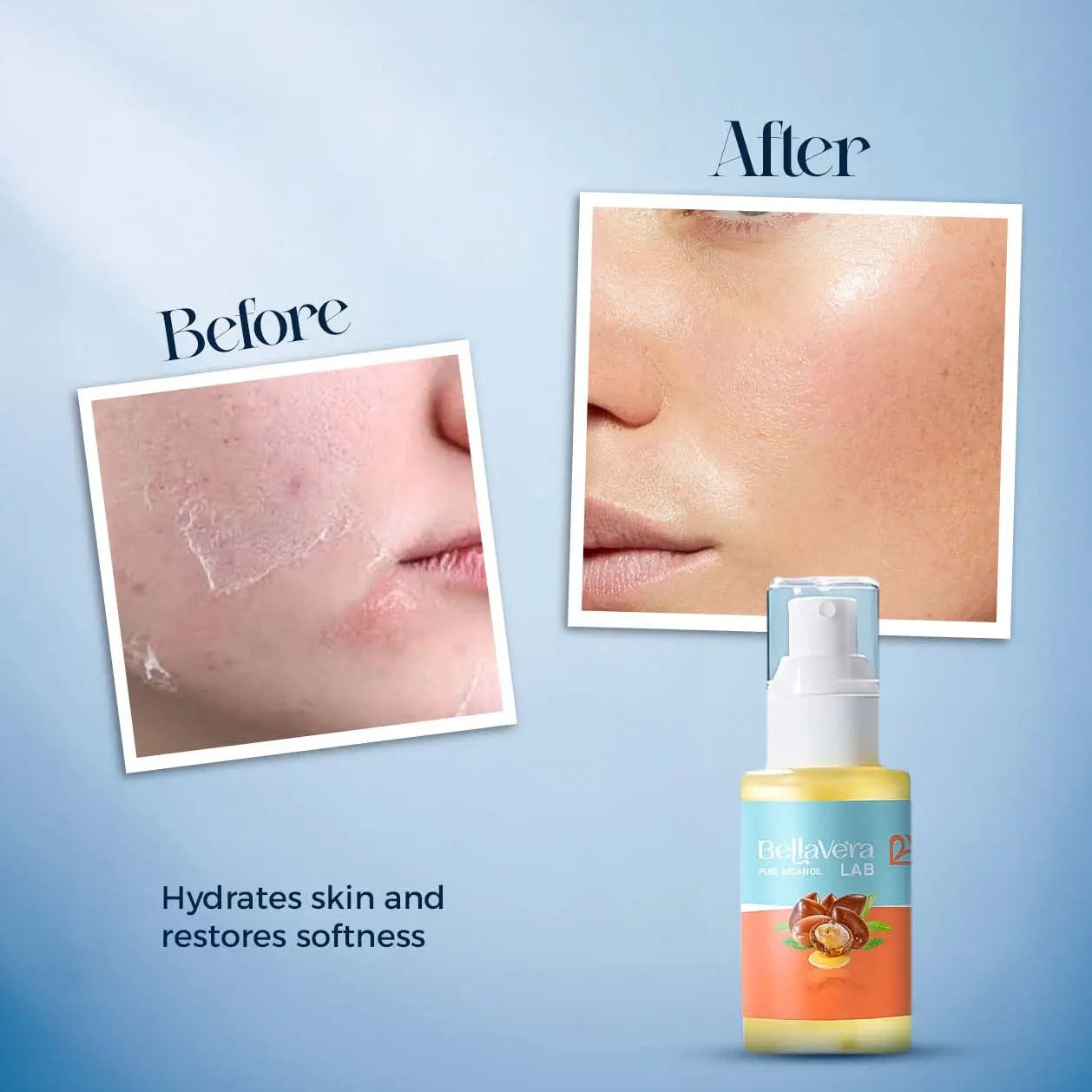 Bellavera Lab - 100% Pure Moroccan Argan Oil (Liquid Gold) - Before and After Hydrates skin 