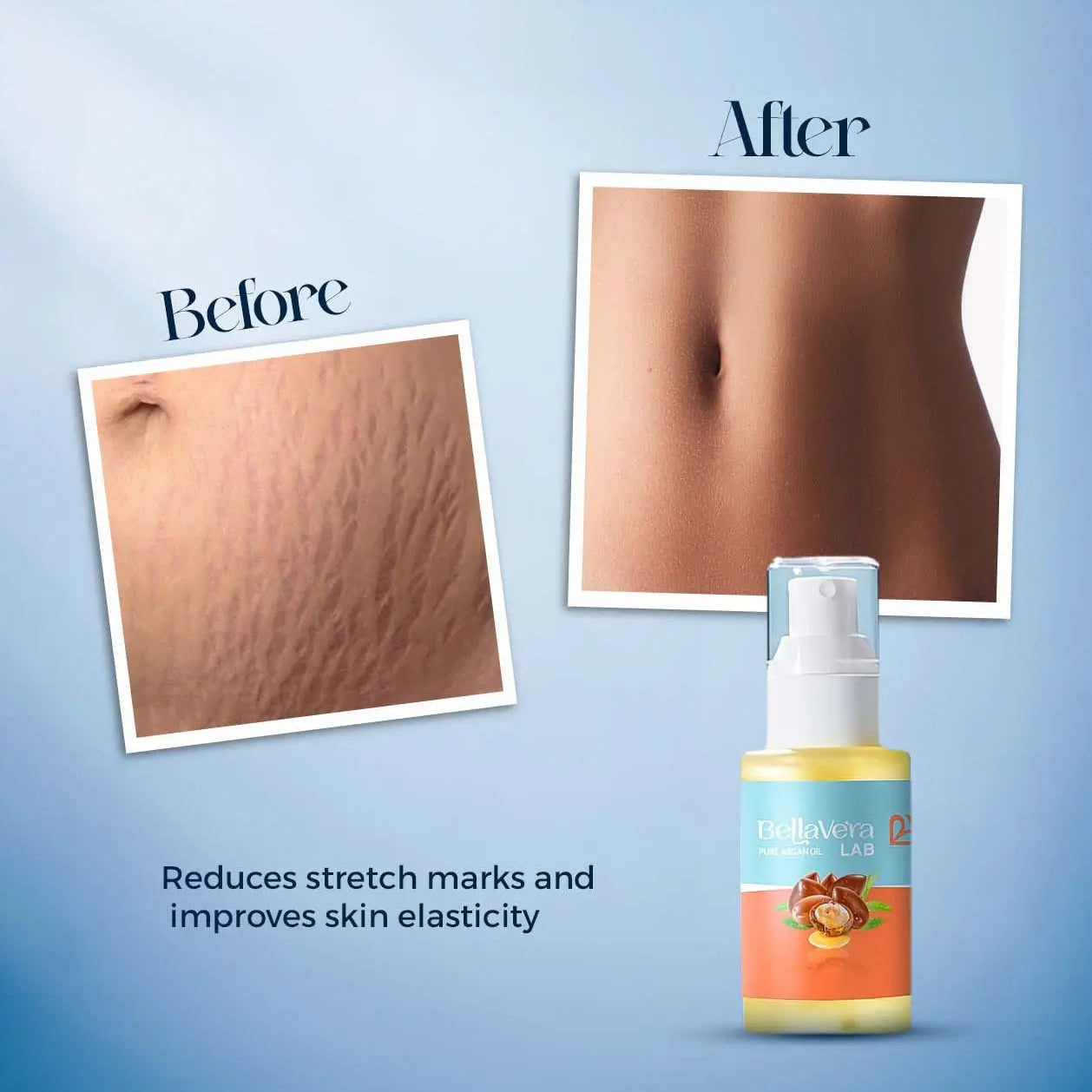 Bellavera Lab - 100% Pure Moroccan Argan Oil (Liquid Gold) - Before and after Reduces stretch marks